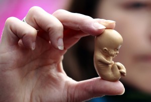 A pro-life campaigner holds up a model of a 12-week-old embryo during a  protest outside the Marie Stopes clinic in Belfast